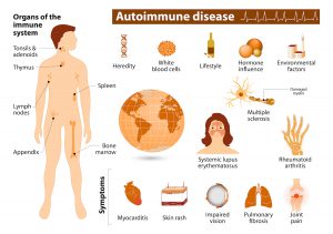 Ubiquitous Autoimmune Conditions