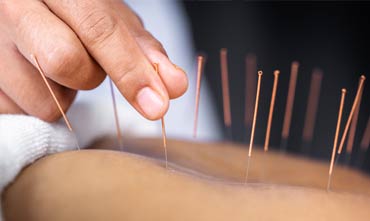 Acupuncture (coming soon!)